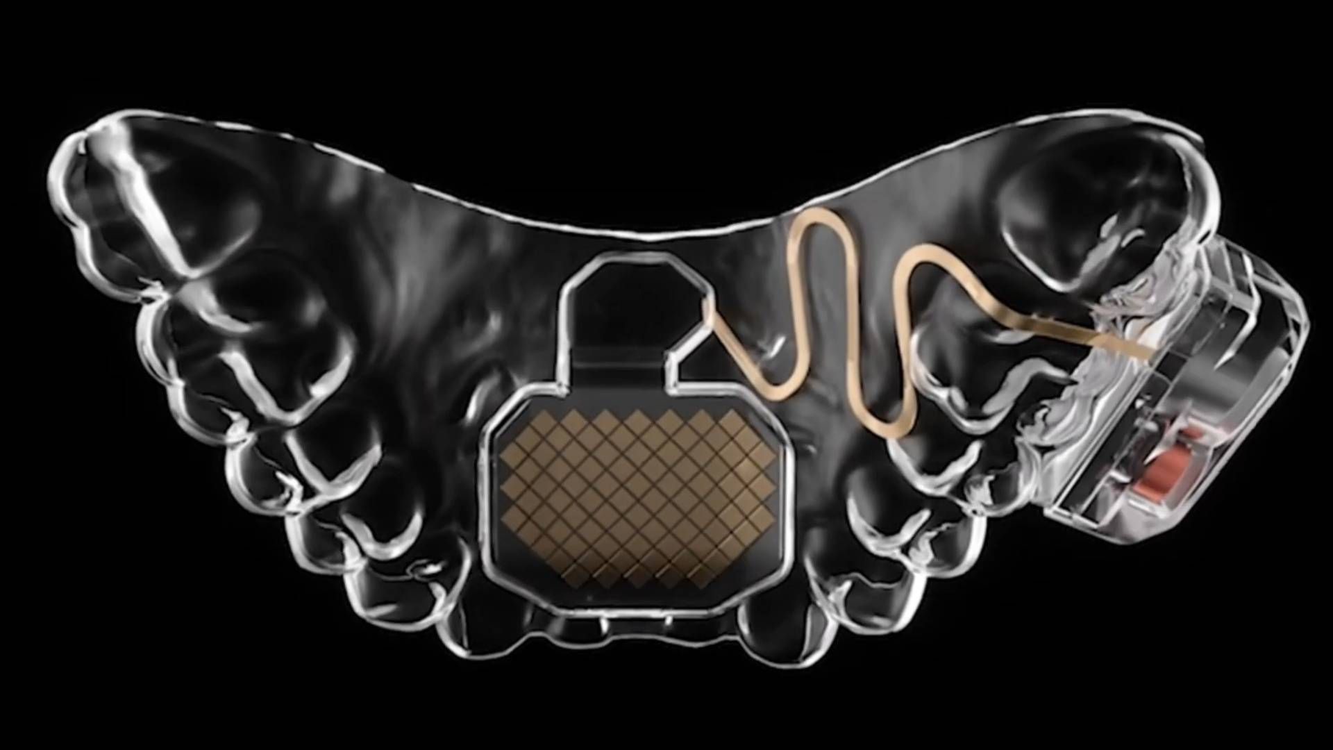 Game with Your Tongue: Mouth Pad Bluetooth Lets You Control Your PC